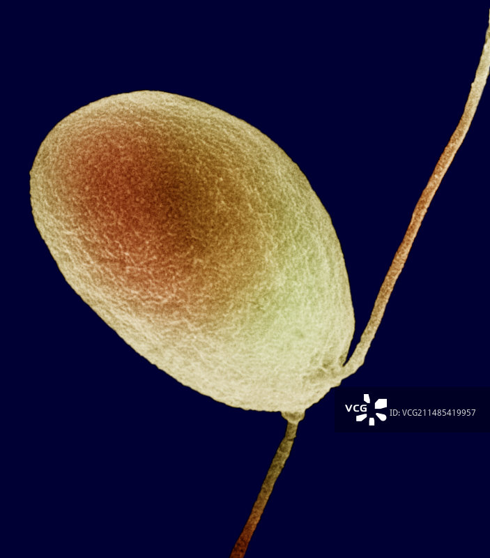 普通淡水绿藻图片素材