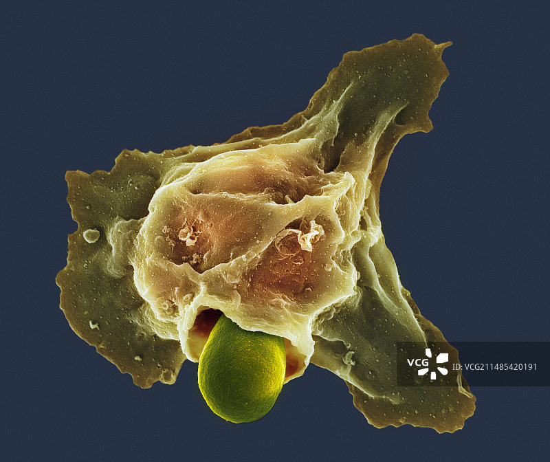 中性粒细胞吞噬鹅口疮真菌，扫描电镜图片素材