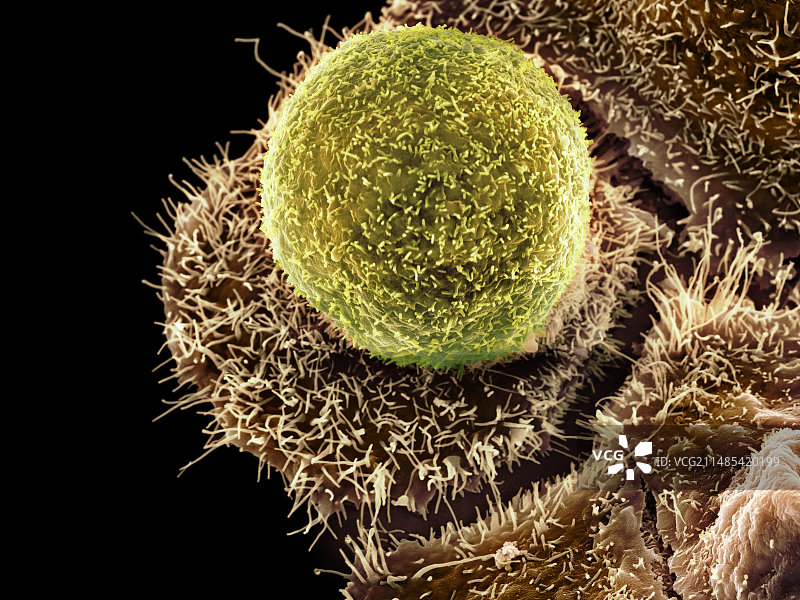 衣原体感染（扫描电子显微镜）图片素材