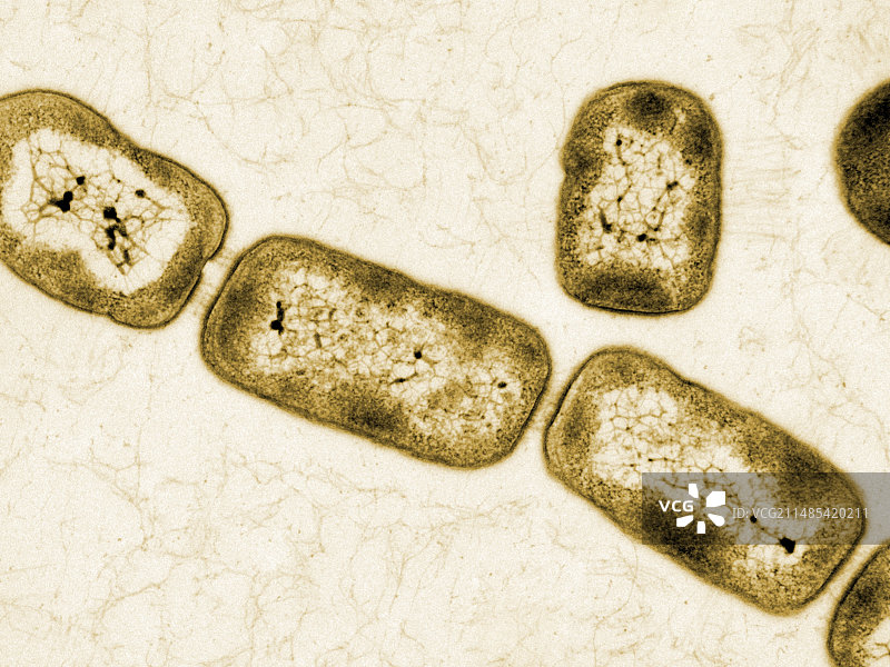 玻璃菌，透射电镜图片素材