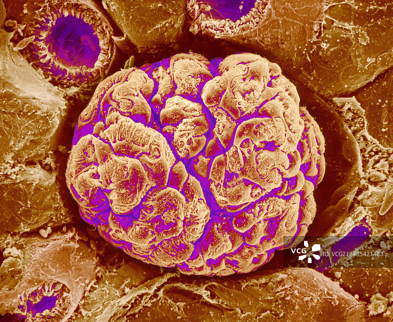 肾小球扫描电镜图图片素材