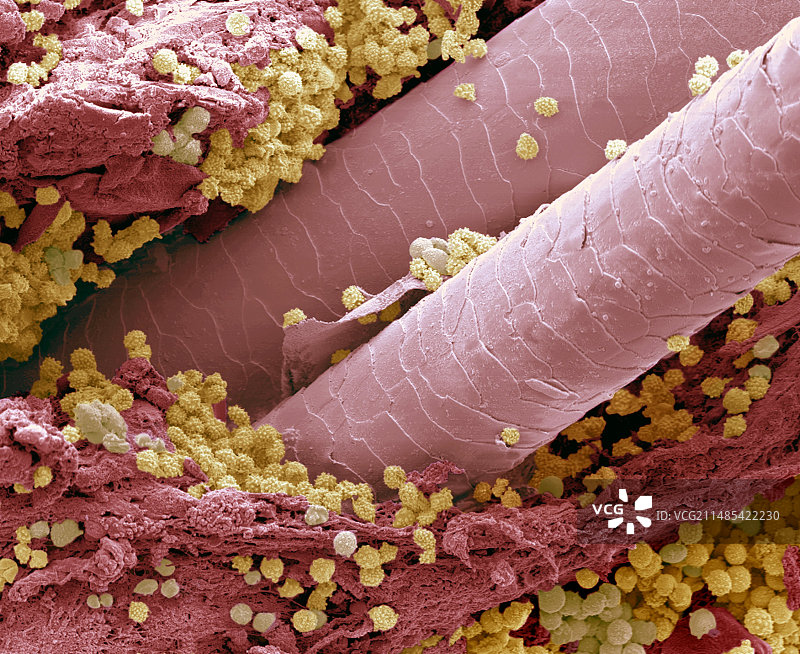 毛囊中的淋巴细胞，扫描电镜图片素材