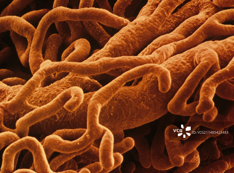 毛细血管，扫描电镜图片素材