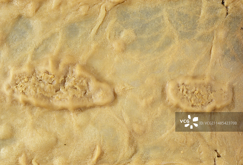 肠道伤寒溃疡图片素材