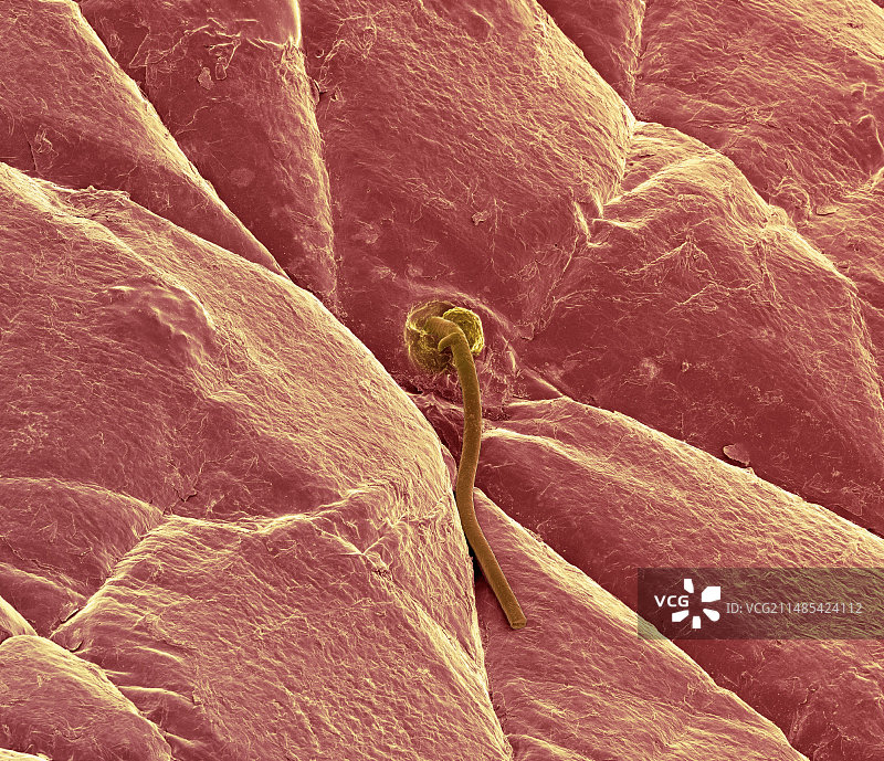 皮肤表面扫描电镜图图片素材