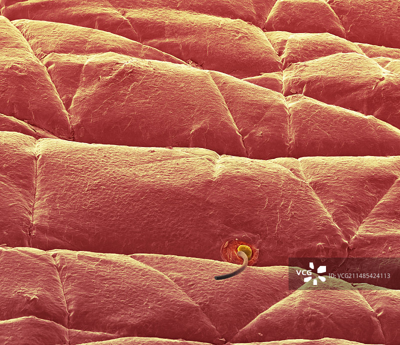 皮肤表面扫描电镜图图片素材