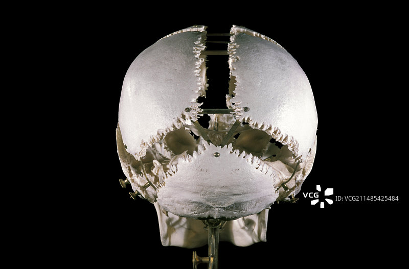 19世纪博谢纳“爆炸”头骨图片素材