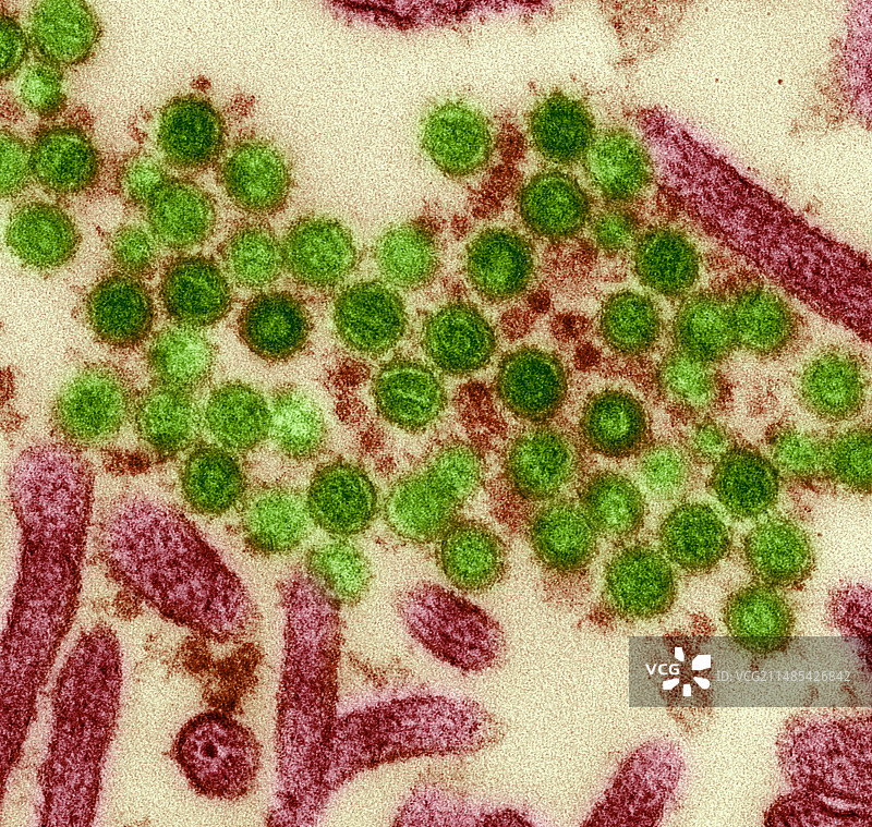小鼠白血病病毒TEM图片素材