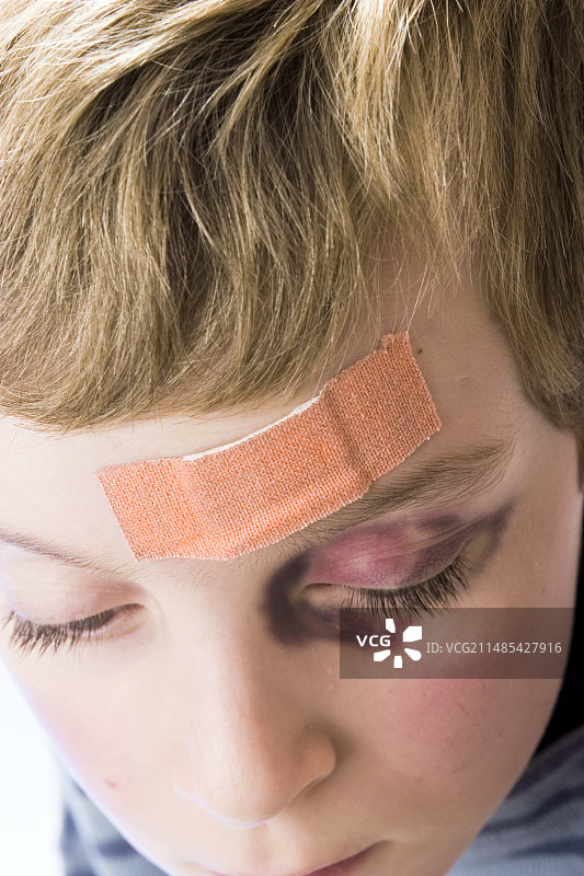 头部受伤和黑眼圈图片素材