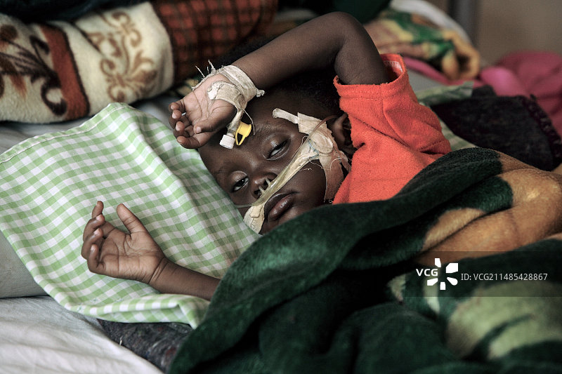 乌干达的儿童患者图片素材