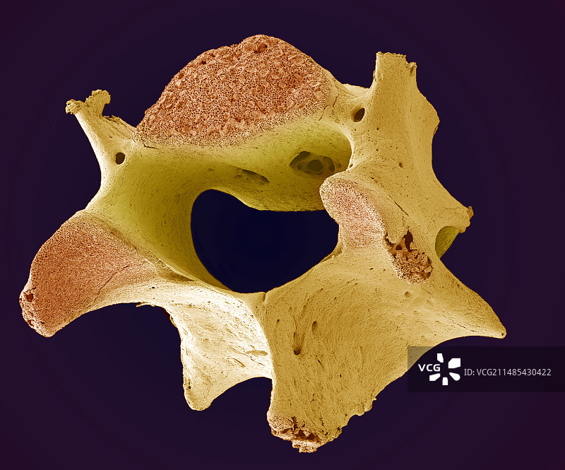 脊椎骨扫描电镜图图片素材