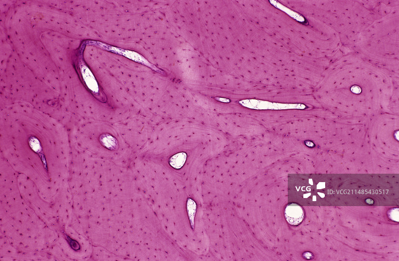 骨骼结构显微照片图片素材