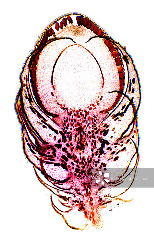 红豆杉雌花显微照片图片素材