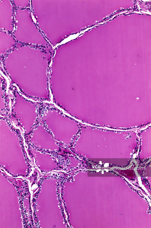 甲状腺光学显微照片图片素材