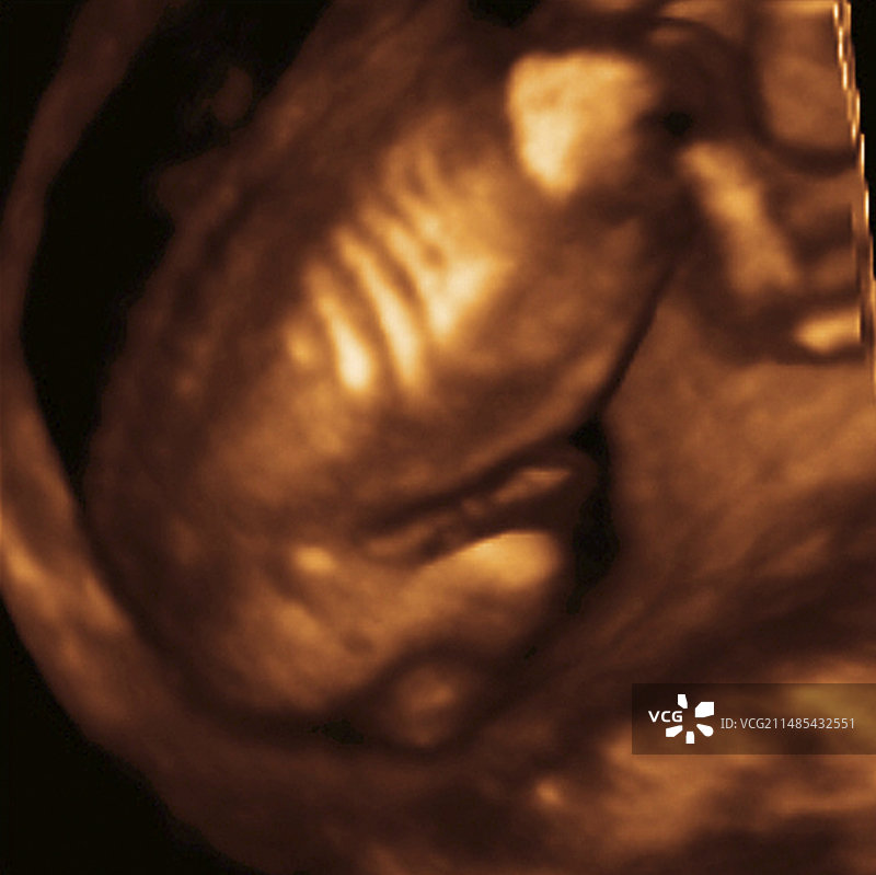 胎儿背部，3D超声波扫描图片素材