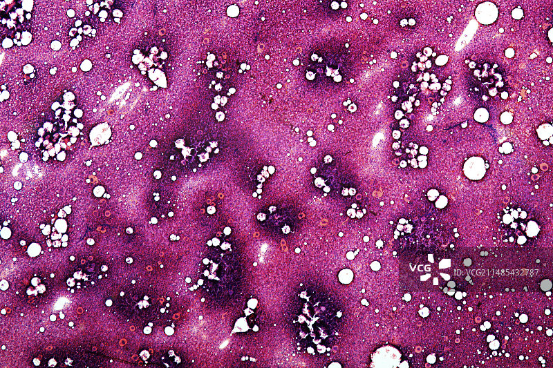 红色骨髓显微照片图片素材