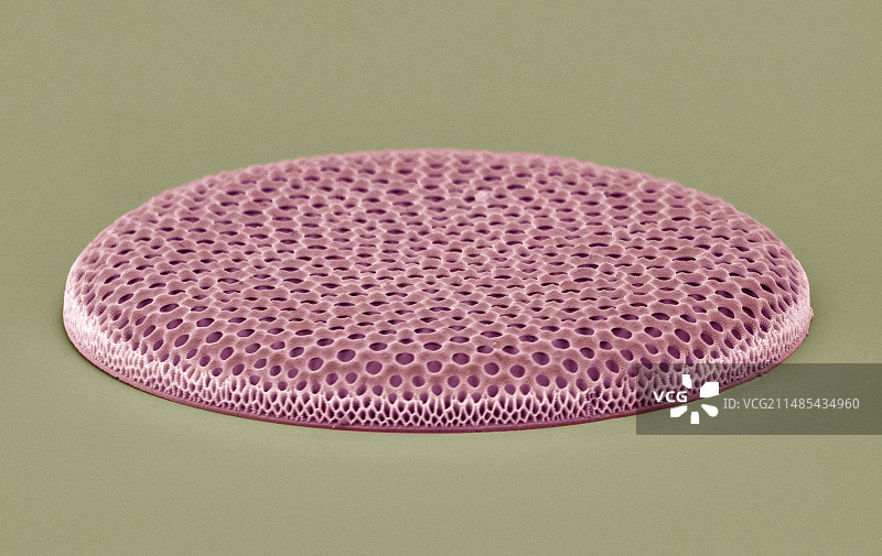 辐射圆盘藻硅藻，扫描电镜图片素材