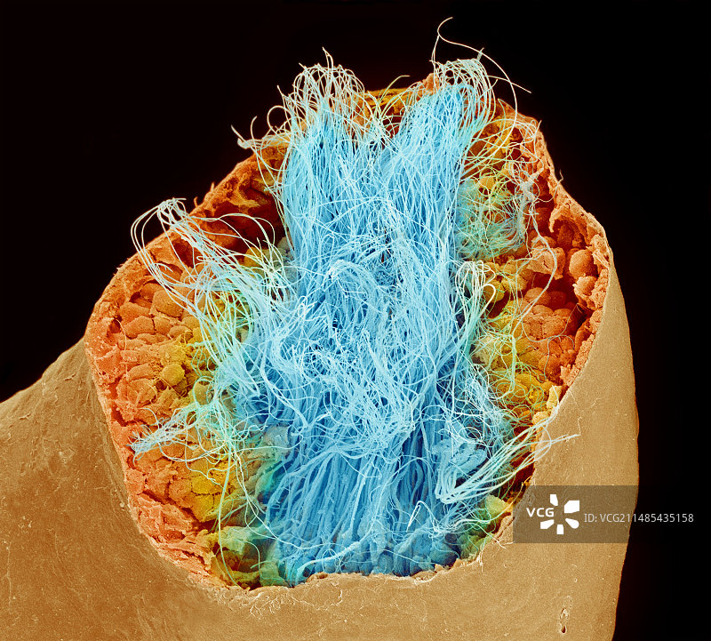 精子产生（扫描电子显微镜图像）图片素材