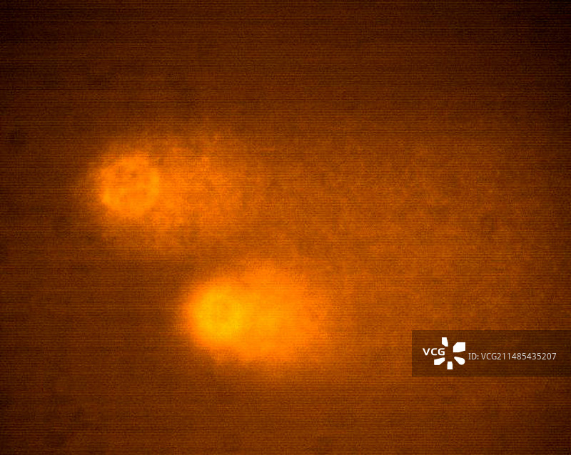 癌症DNA检测图片素材