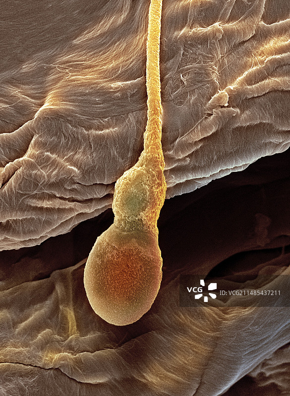 变形的精子细胞扫描电镜图图片素材