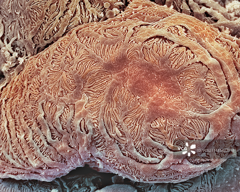 肾小球扫描电镜图图片素材