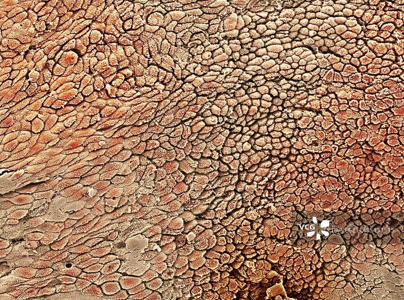 宫颈内膜扫描电镜图图片素材