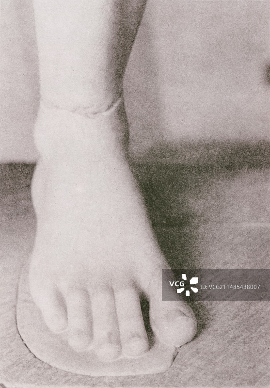 脚踝和足部图片素材