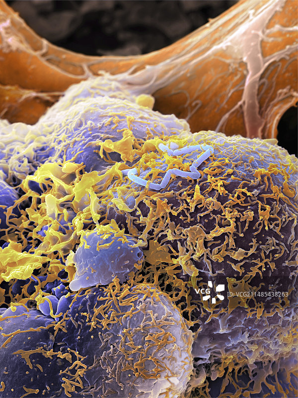 李斯特菌，扫描电镜图图片素材