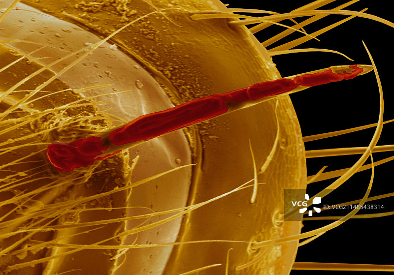 蚂蚁叮咬ESEM图片素材