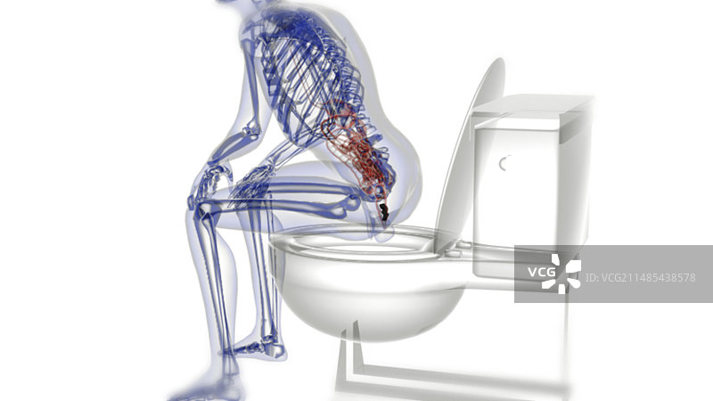排泄物X光片艺术作品图片素材