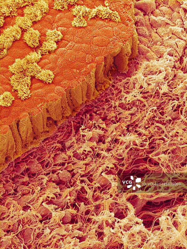 气管内壁扫描电镜图片素材