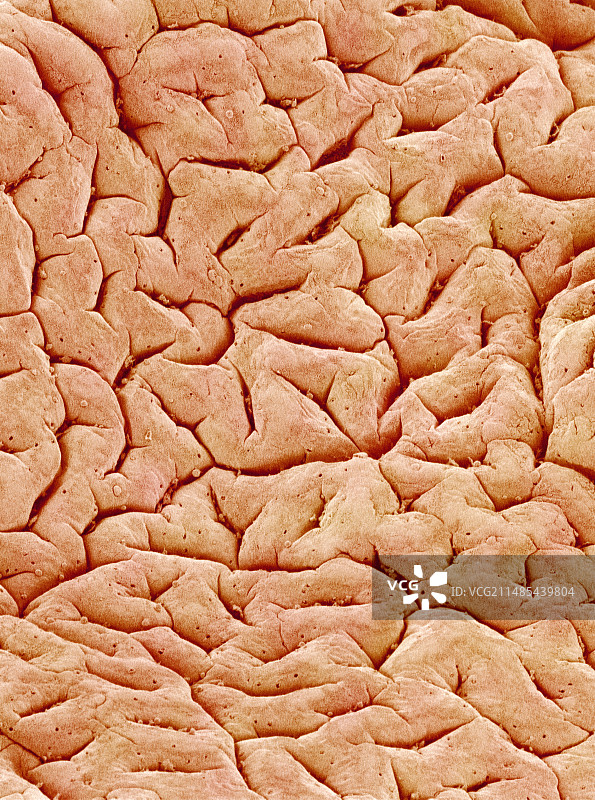 结肠黏膜图片素材