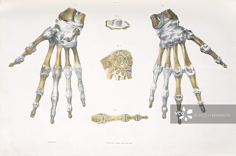 手部骨骼与韧带图片素材