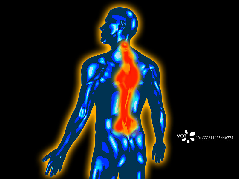 背部疼痛图片素材
