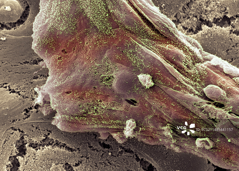 干细胞，扫描电子显微镜图片素材