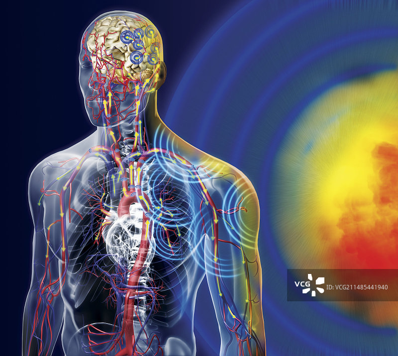 爆炸伤示意图图片素材