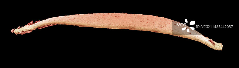 修剪指甲扫描电镜图图片素材