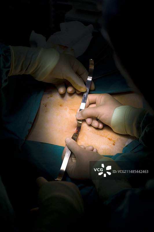 微创手术图片素材