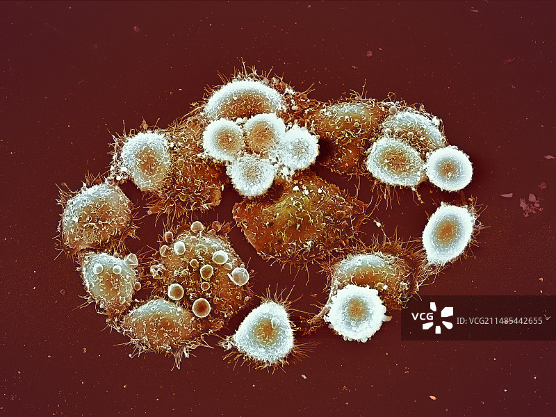 HeLa细胞，扫描电镜图片素材