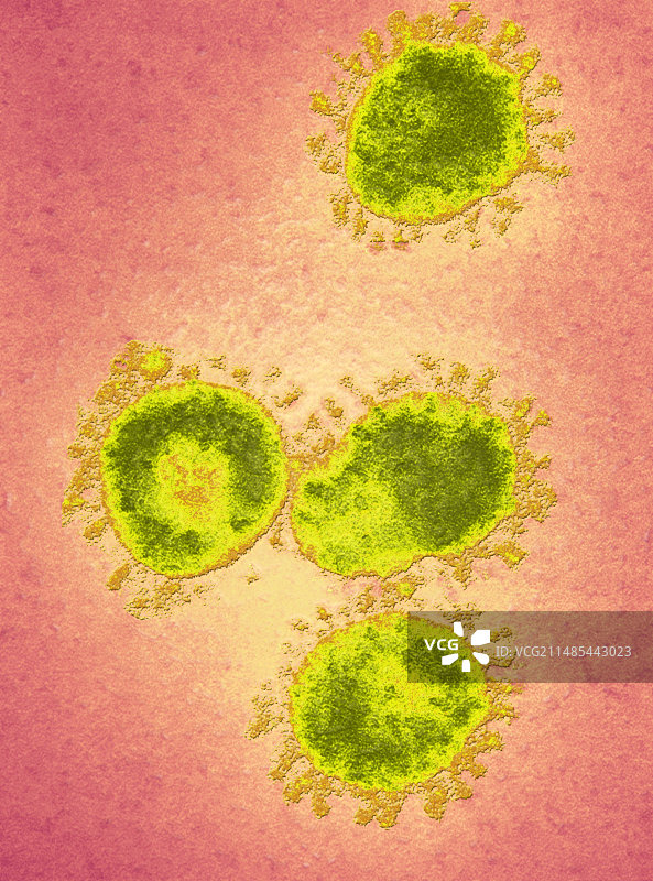 传染性支气管炎病毒 (IBV), TEM图片素材