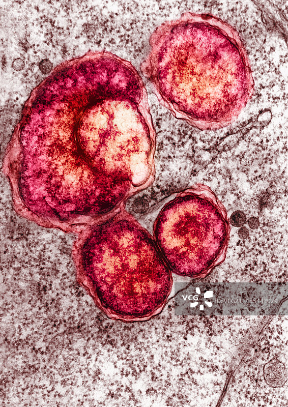 感染细菌的蚊子卵巢(TEM)图片素材