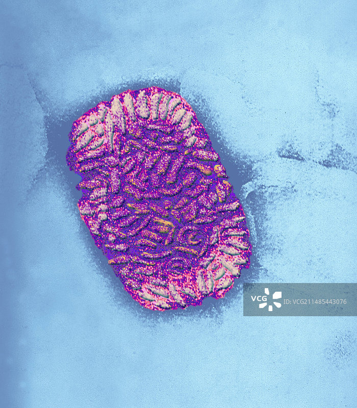 牛痘病毒颗粒（TEM）图片素材
