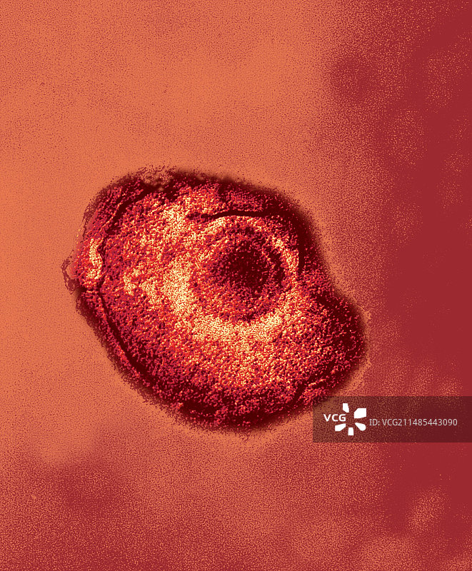 水痘带状疱疹病毒颗粒（透射电镜）图片素材