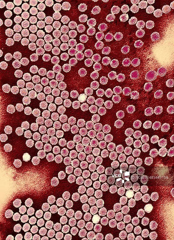 脊髓灰质炎病毒颗粒，TEM图片素材