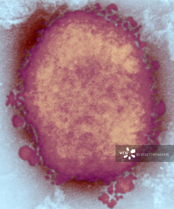猴痘病毒颗粒（透射电子显微镜）图片素材