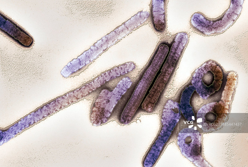 马尔堡病毒，TEM图片素材