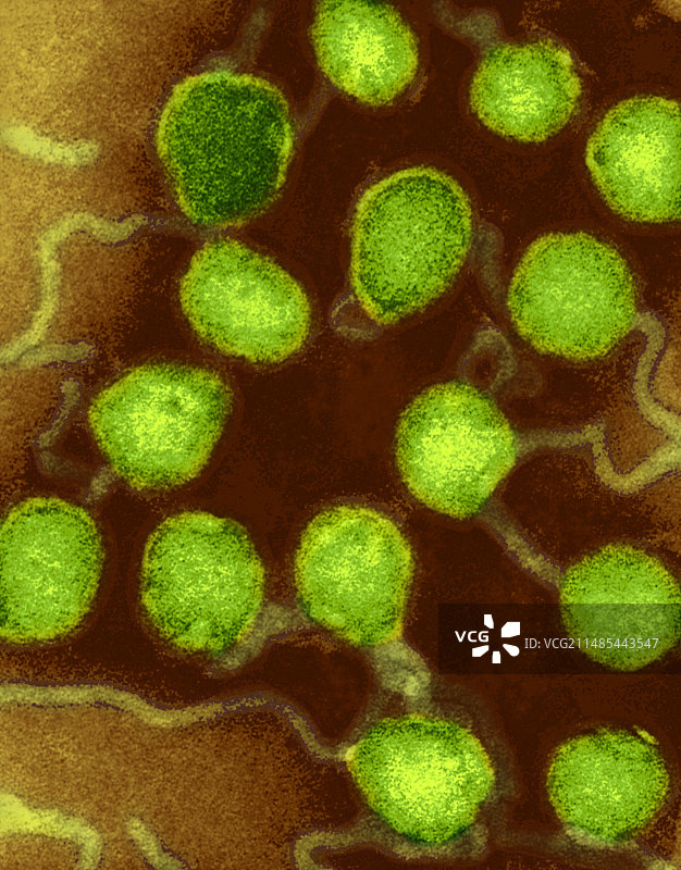 拉克罗斯脑炎病毒（透射电镜）图片素材