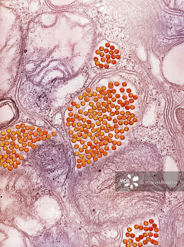 东部马脑炎病毒，TEM图片素材