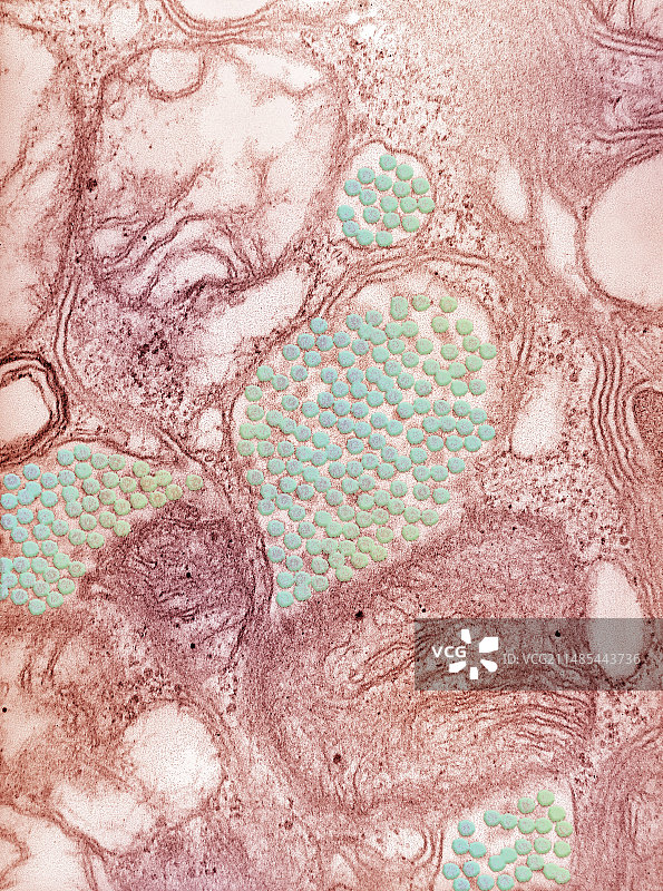 东部马脑炎病毒，TEM图片素材