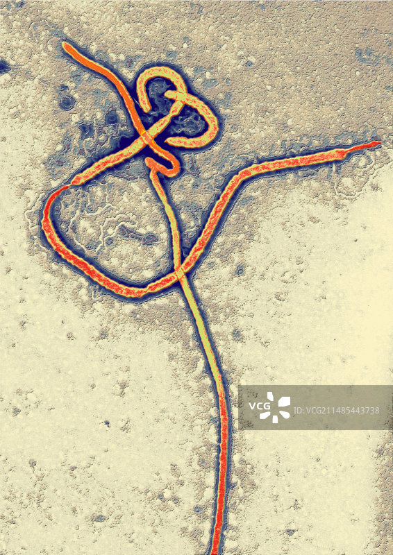 埃博拉病毒颗粒电镜图图片素材